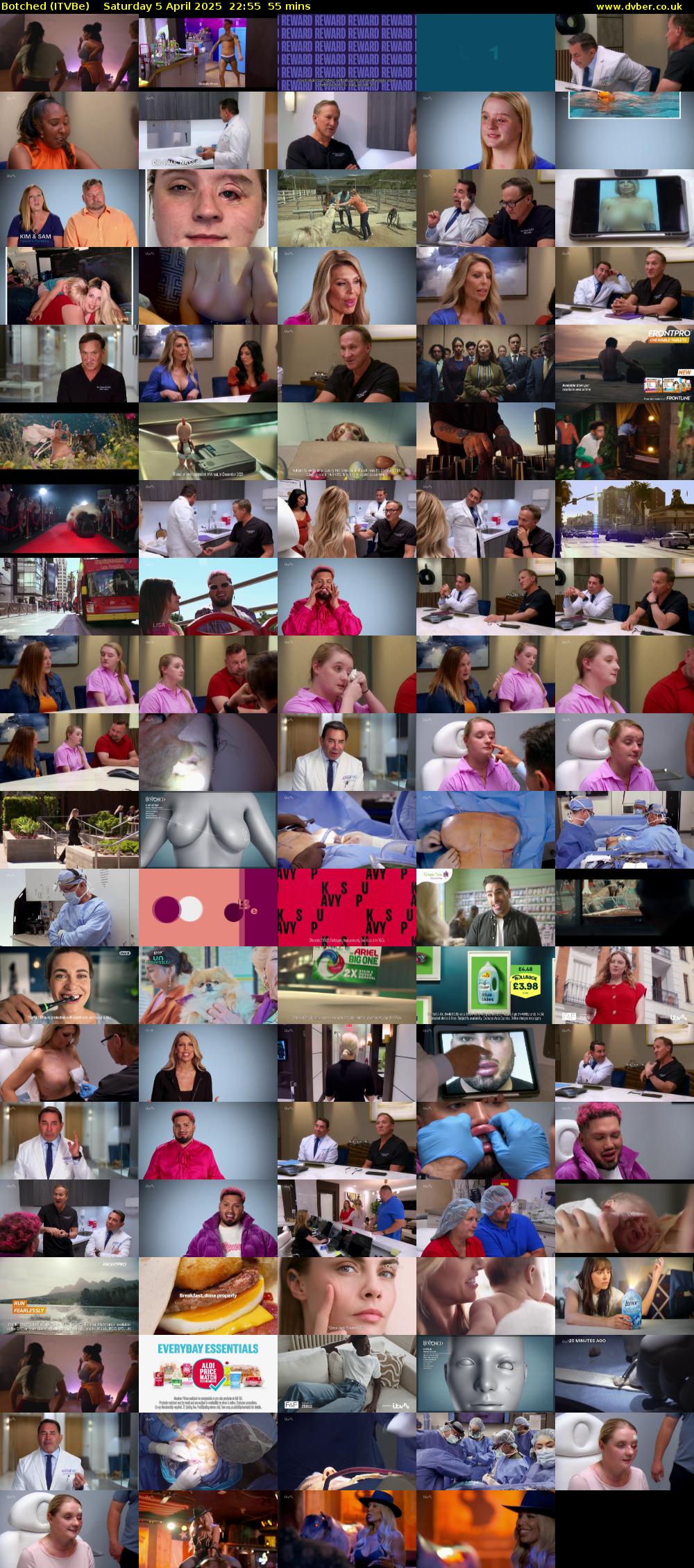 Botched (ITVBe) Saturday 5 April 2025 22:55 - 23:50