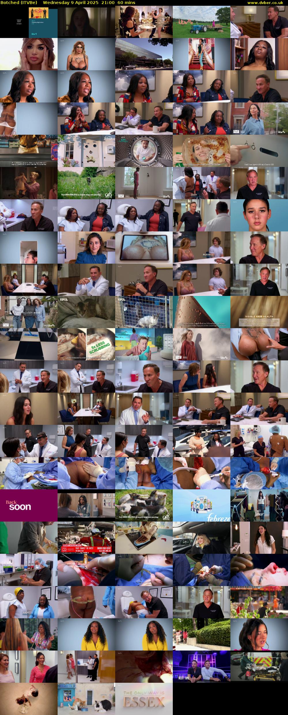 Botched (ITVBe) Wednesday 9 April 2025 21:00 - 22:00