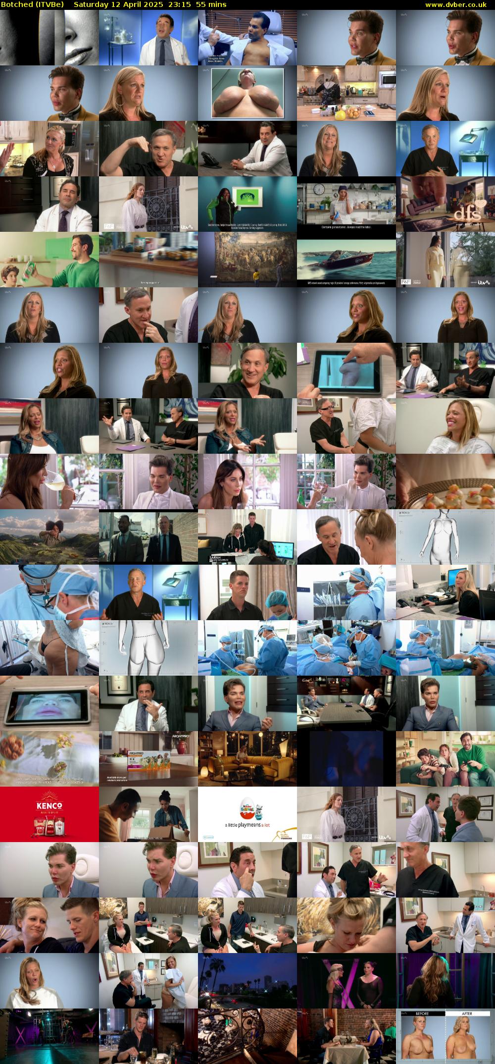 Botched (ITVBe) Saturday 12 April 2025 23:15 - 00:10
