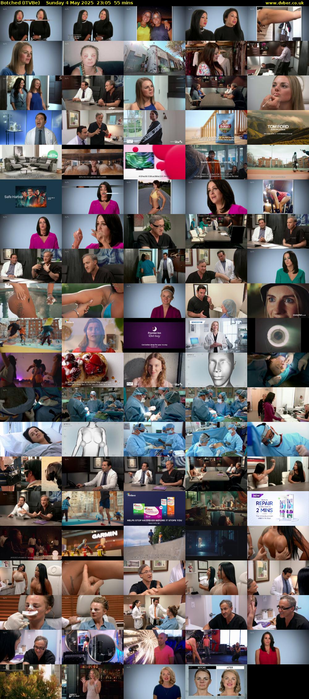 Botched (ITVBe) Sunday 4 May 2025 23:05 - 00:00