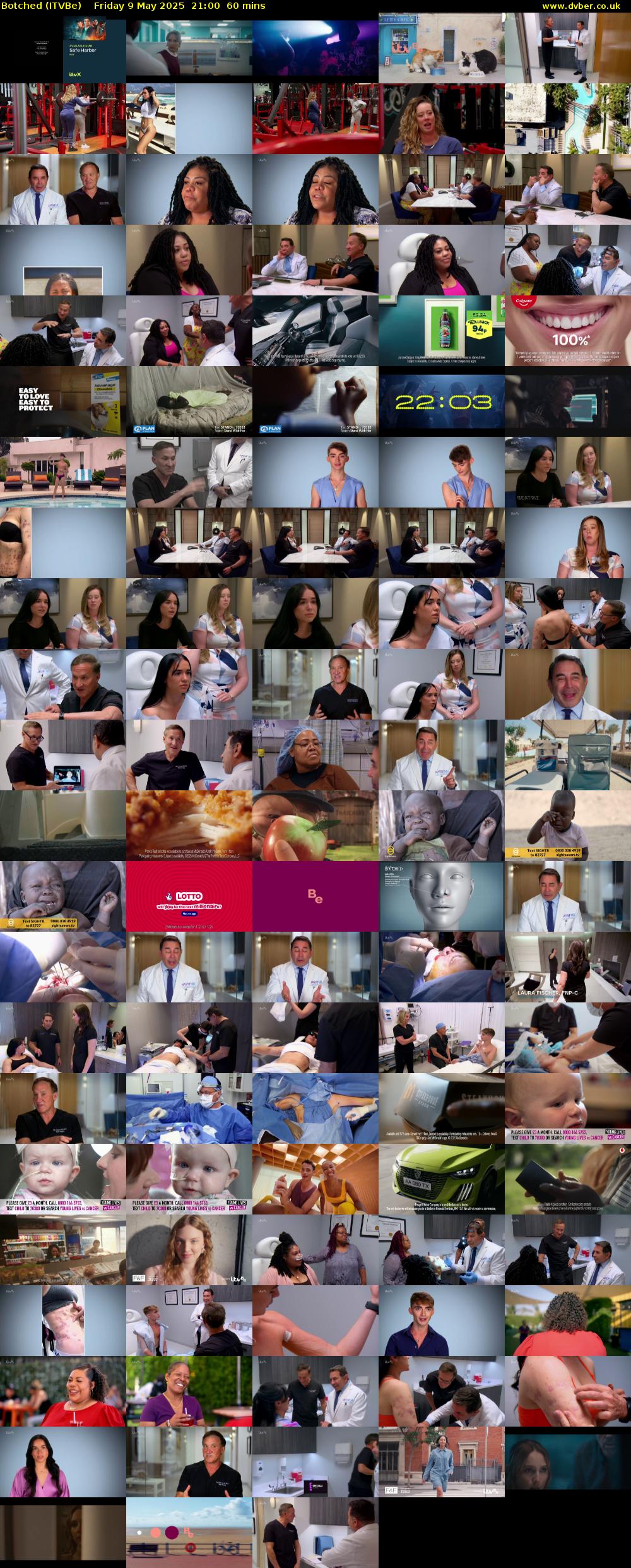 Botched (ITVBe) Friday 9 May 2025 21:00 - 22:00