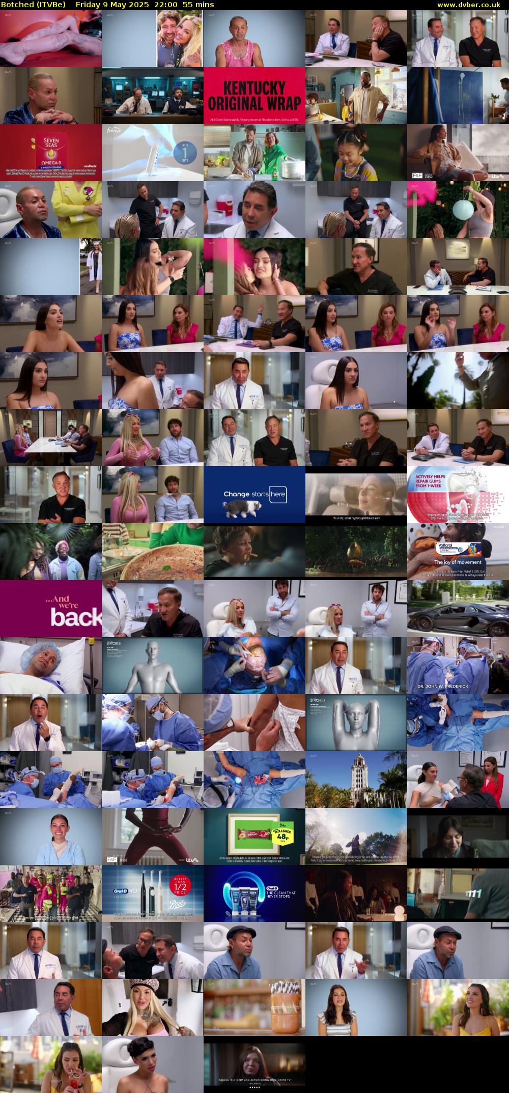 Botched (ITVBe) Friday 9 May 2025 22:00 - 22:55