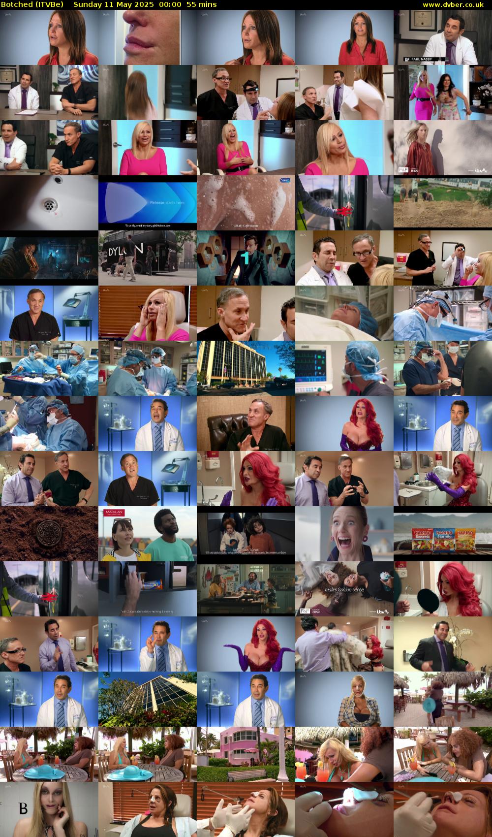 Botched (ITVBe) Sunday 11 May 2025 00:00 - 00:55