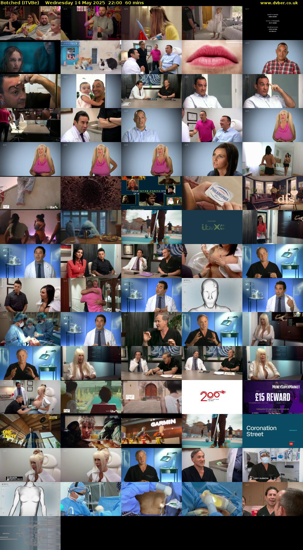 Botched (ITVBe) Wednesday 14 May 2025 22:00 - 23:00