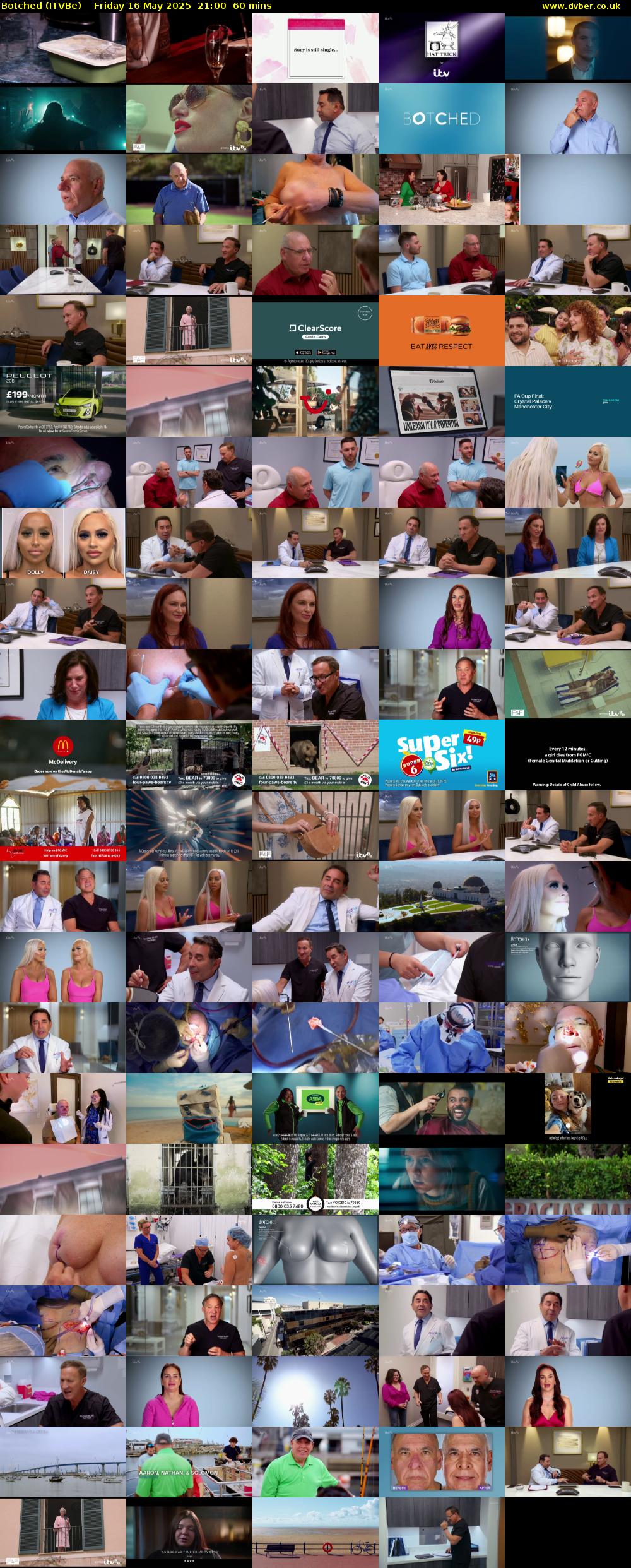 Botched (ITVBe) Friday 16 May 2025 21:00 - 22:00
