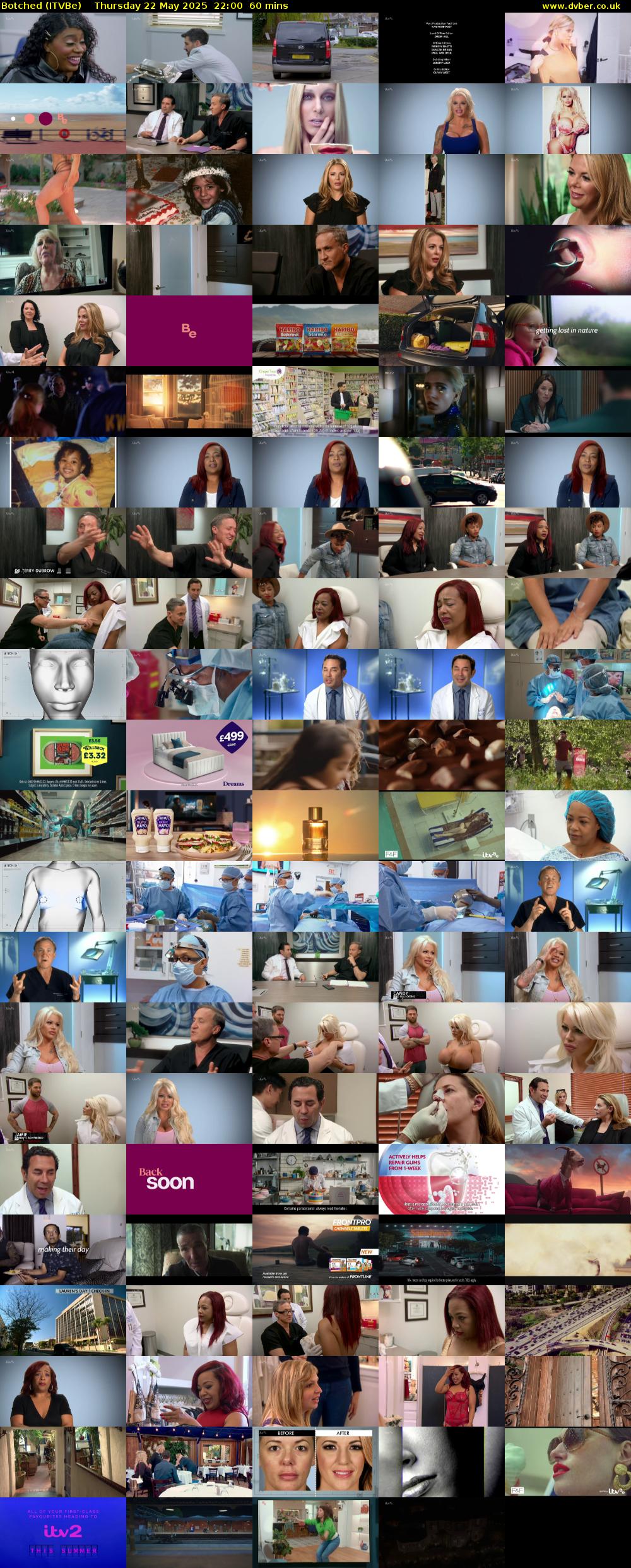 Botched (ITVBe) Thursday 22 May 2025 22:00 - 23:00