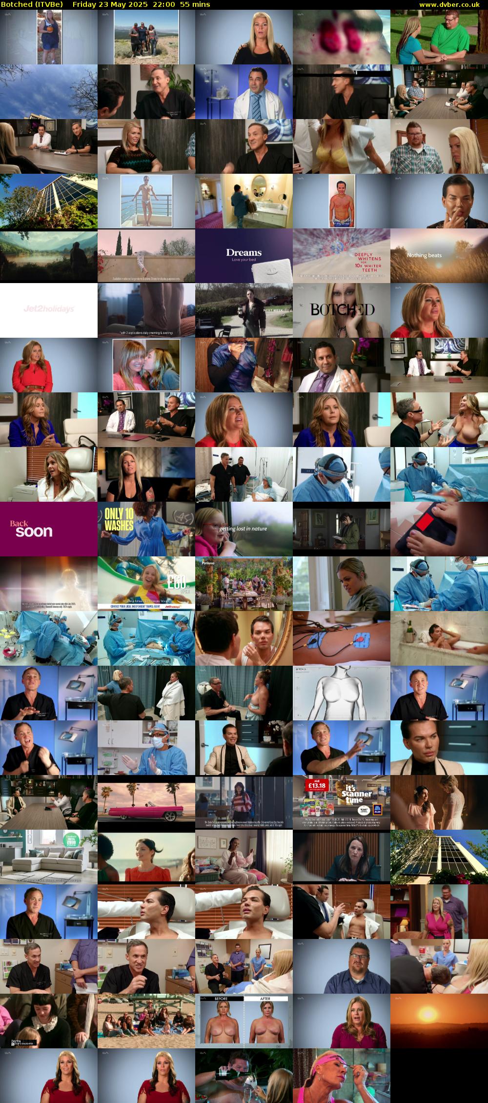 Botched (ITVBe) Friday 23 May 2025 22:00 - 22:55
