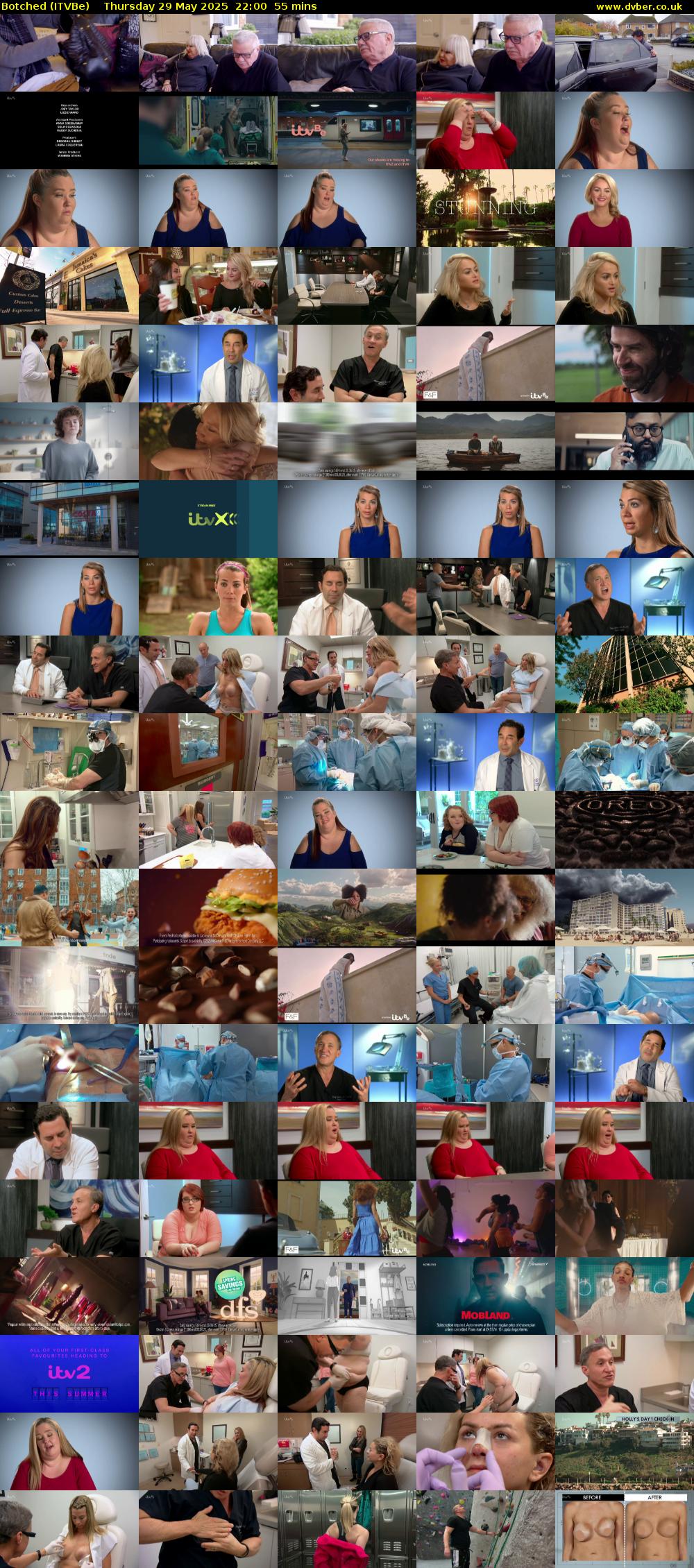 Botched (ITVBe) Thursday 29 May 2025 22:00 - 22:55