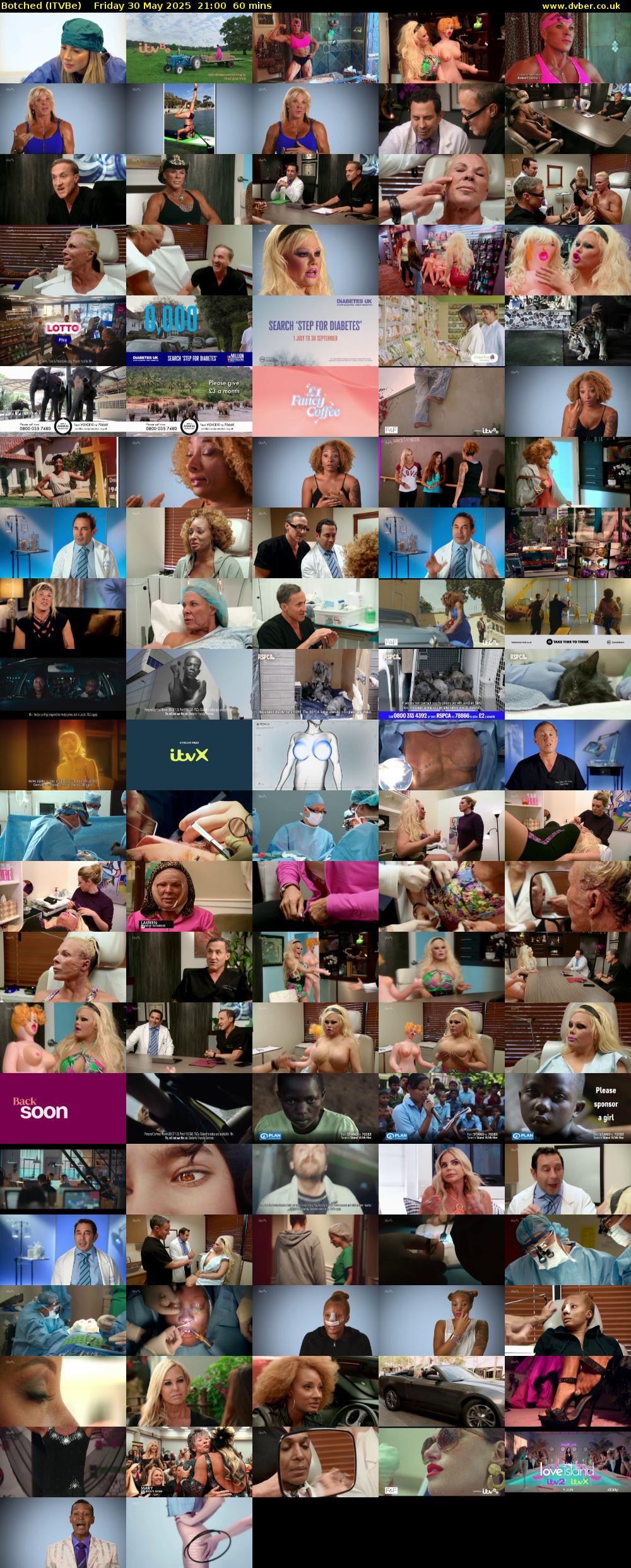 Botched (ITVBe) Friday 30 May 2025 21:00 - 22:00