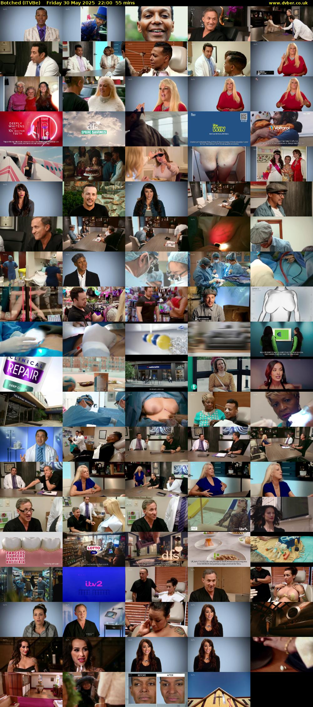 Botched (ITVBe) Friday 30 May 2025 22:00 - 22:55