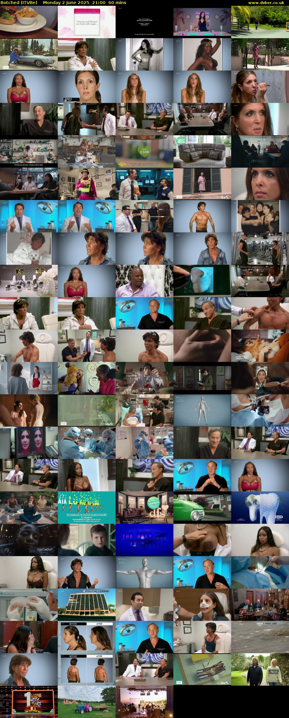 Botched (ITVBe) Monday 2 June 2025 21:00 - 22:00