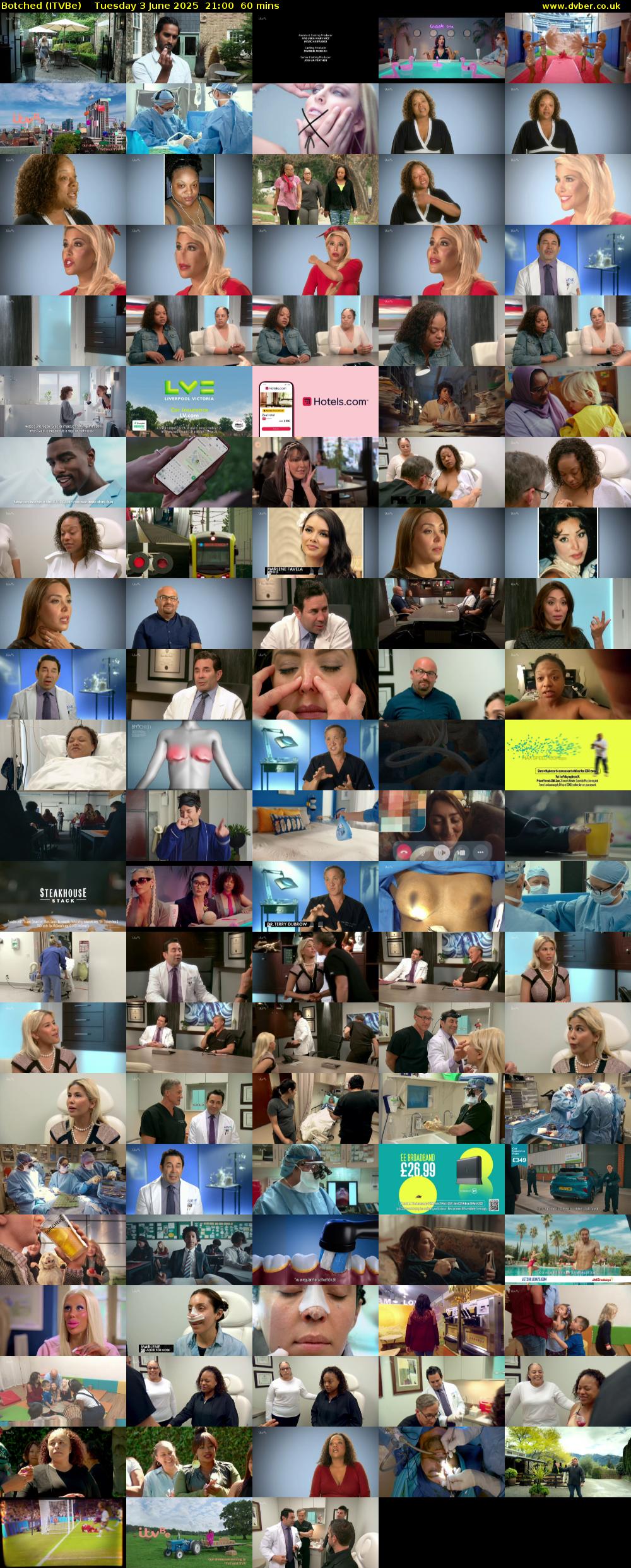 Botched (ITVBe) Tuesday 3 June 2025 21:00 - 22:00