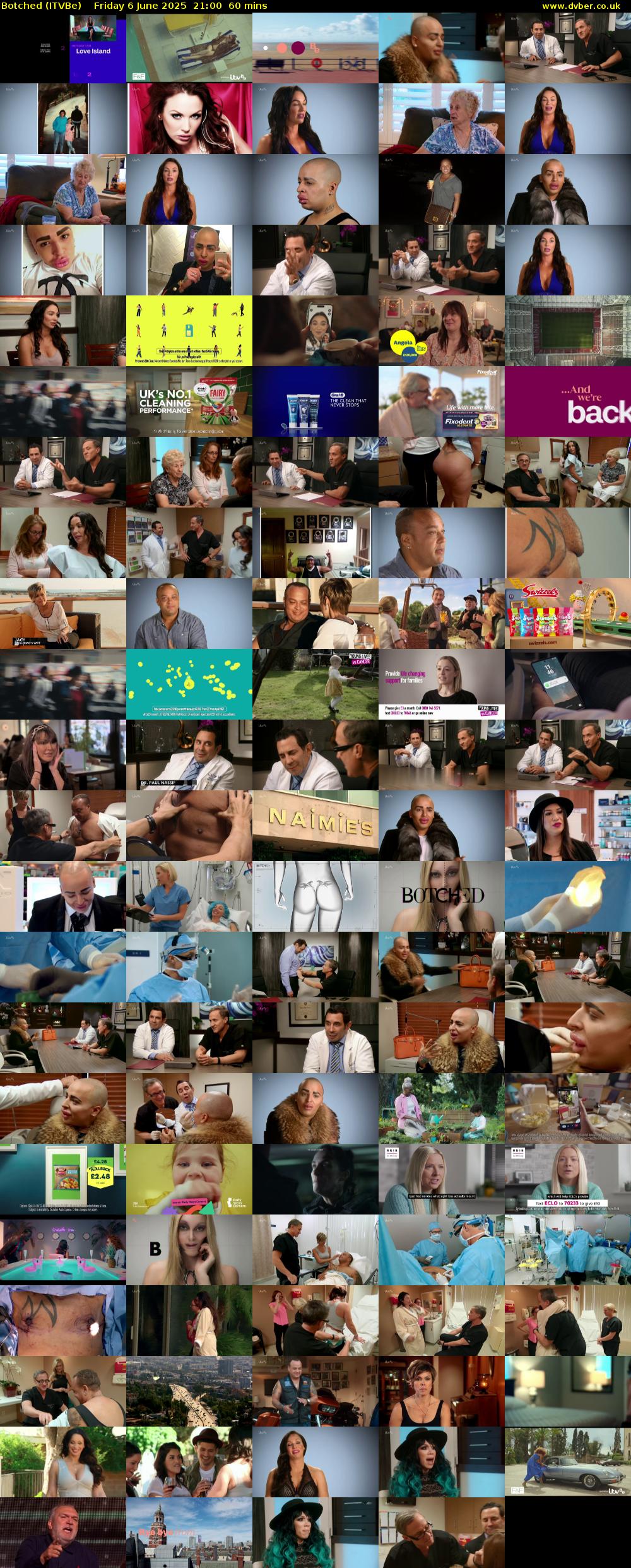 Botched (ITVBe) Friday 6 June 2025 21:00 - 22:00