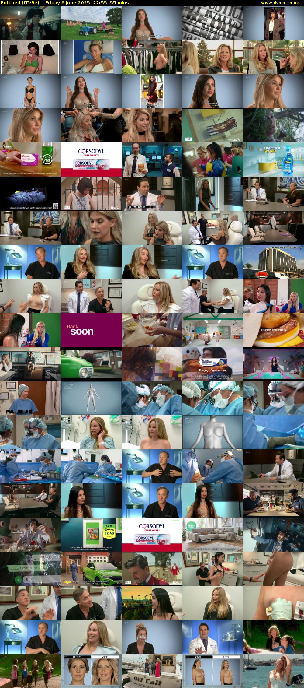 Botched (ITVBe) Friday 6 June 2025 22:55 - 23:50