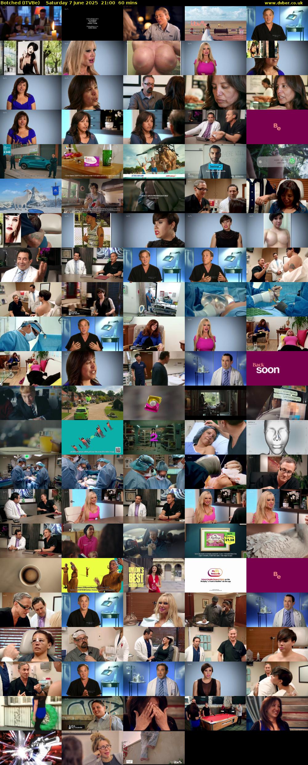 Botched (ITVBe) Saturday 7 June 2025 21:00 - 22:00