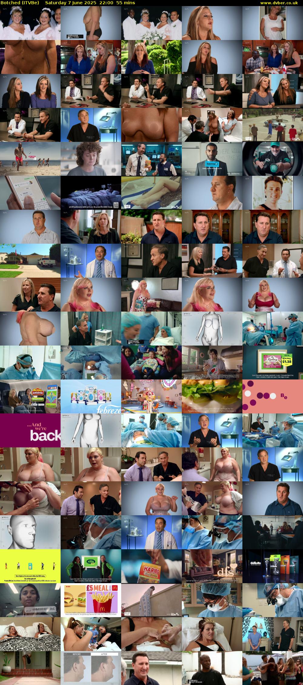 Botched (ITVBe) Saturday 7 June 2025 22:00 - 22:55