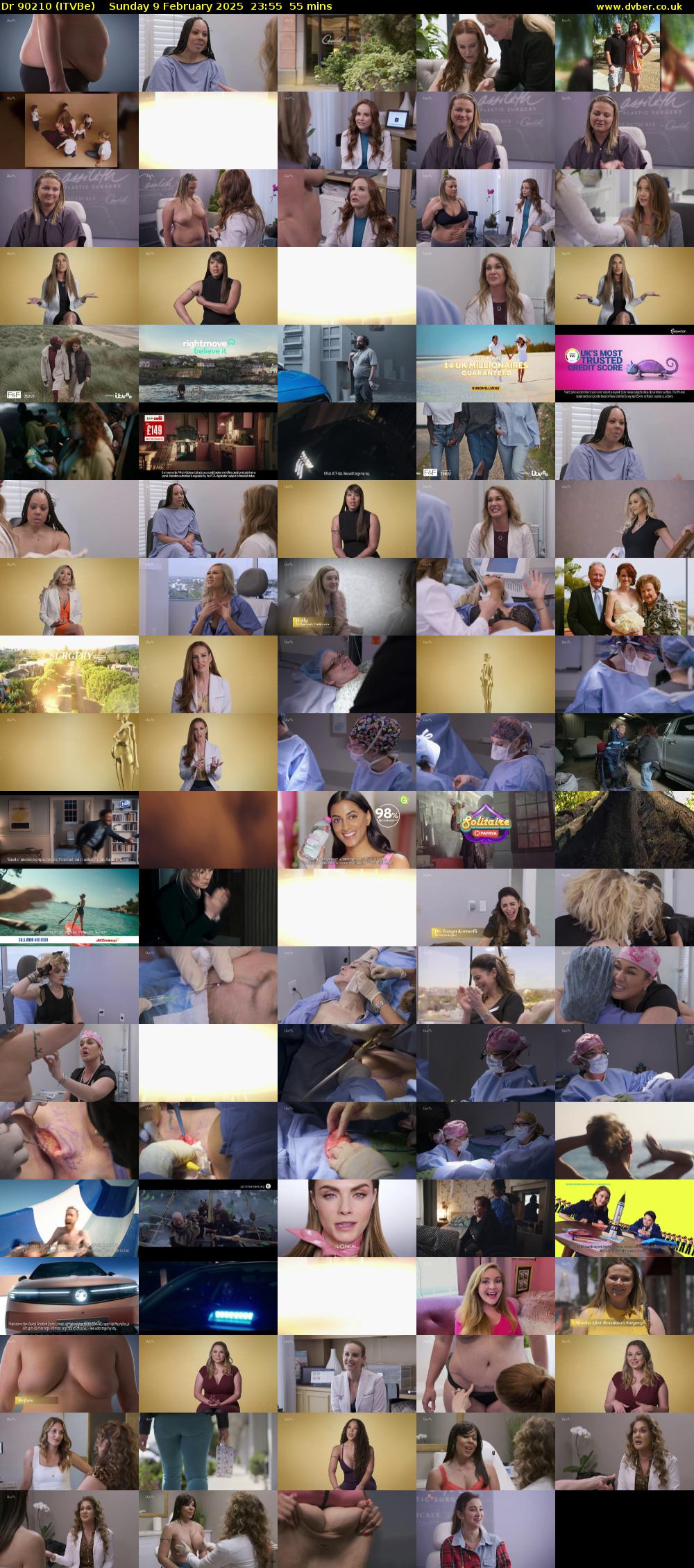 Dr 90210 (ITVBe) Sunday 9 February 2025 23:55 - 00:50