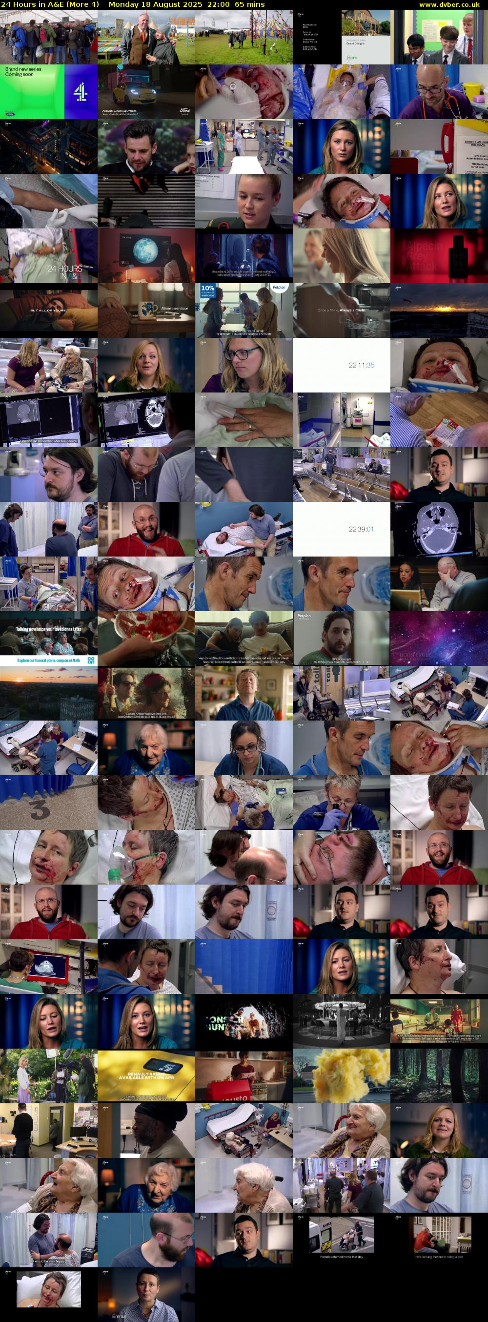 24 Hours in A&E (More 4) Monday 18 August 2025 22:00 - 23:05