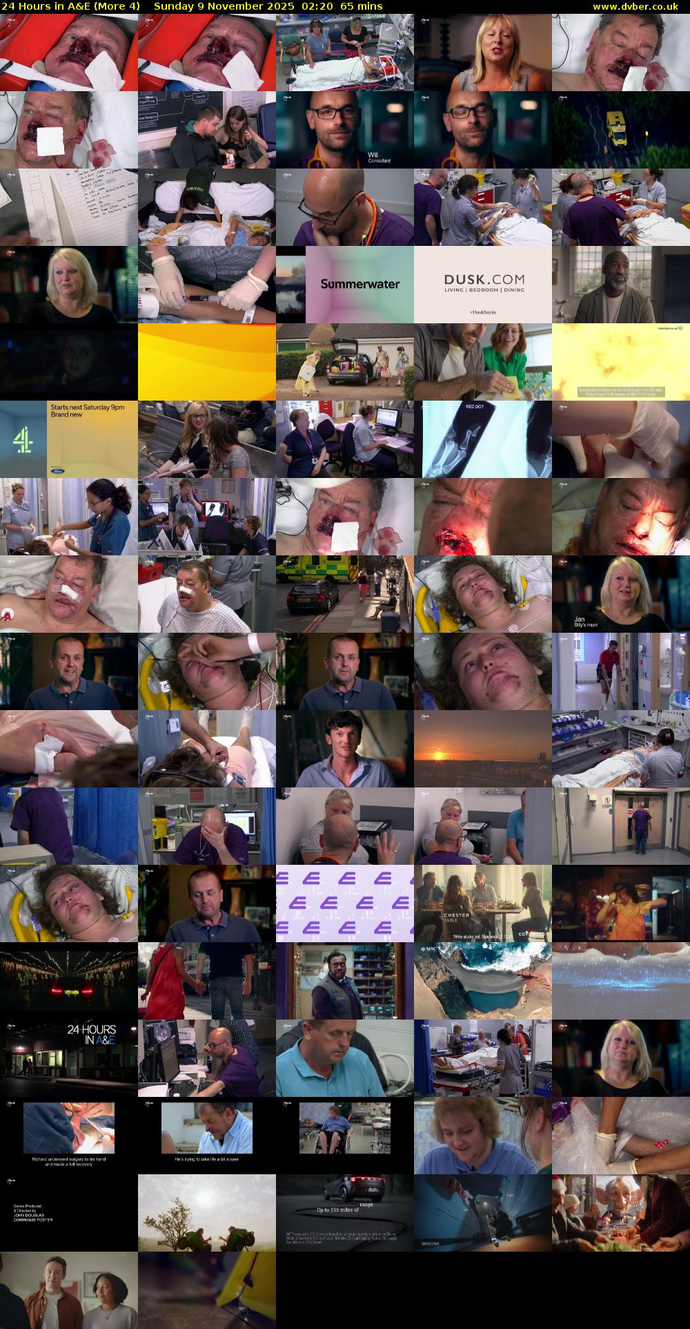 24 Hours in A&E (More 4) Sunday 9 November 2025 02:20 - 03:25
