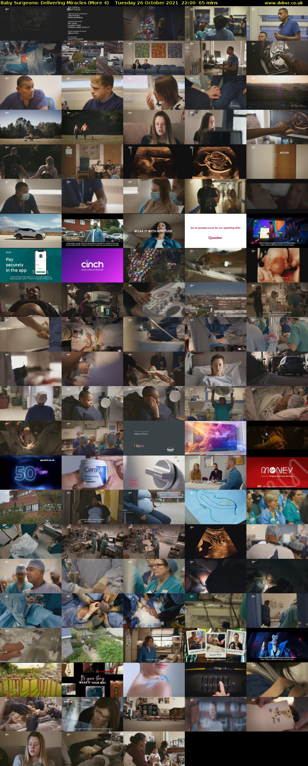 Baby Surgeons: Delivering Miracles (More 4) Tuesday 26 October 2021 22:00 - 23:05