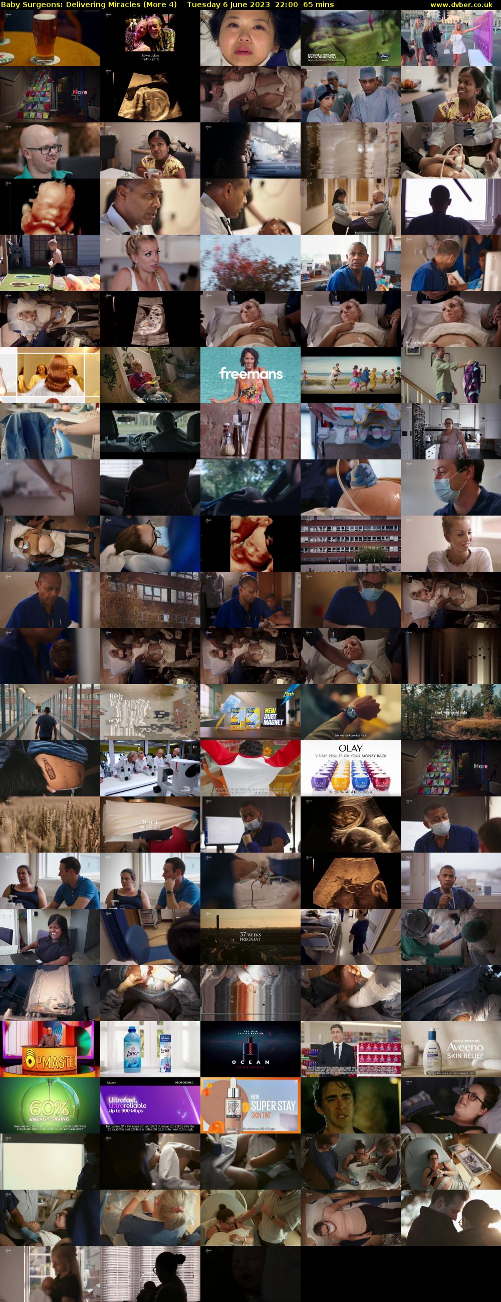 Baby Surgeons: Delivering Miracles (More 4) Tuesday 6 June 2023 22:00 - 23:05