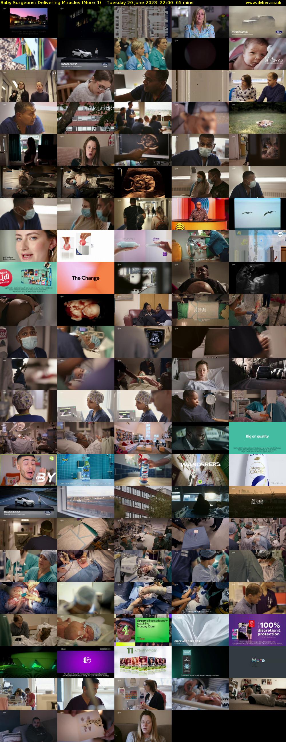 Baby Surgeons: Delivering Miracles (More 4) Tuesday 20 June 2023 22:00 - 23:05