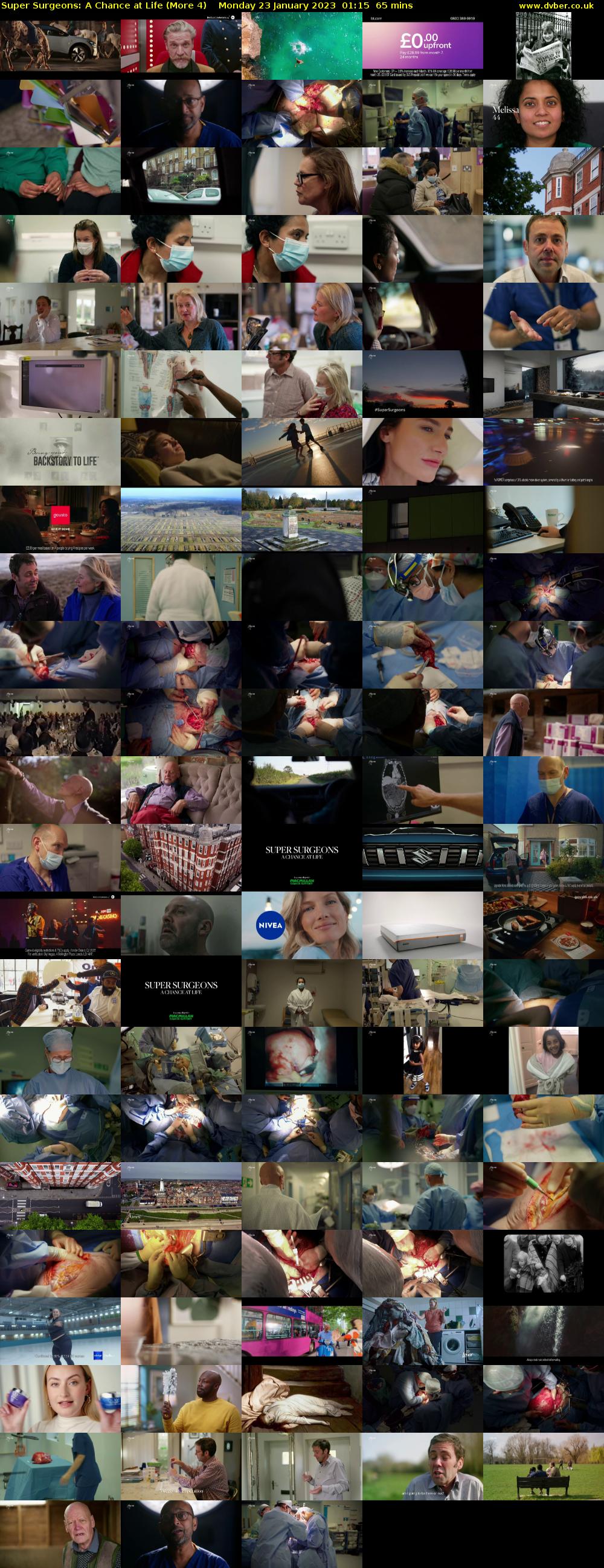 Super Surgeons: A Chance at Life (More 4) Monday 23 January 2023 01:15 - 02:20