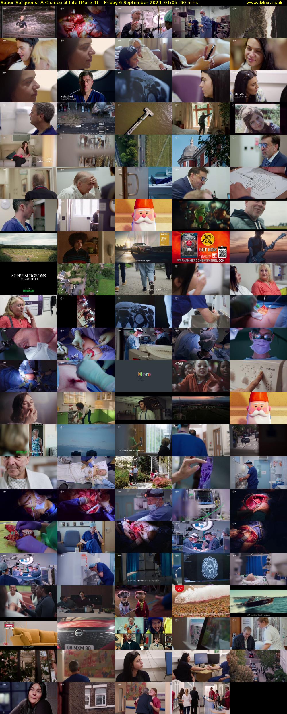 Super Surgeons: A Chance at Life (More 4) Friday 6 September 2024 01:05 - 02:05