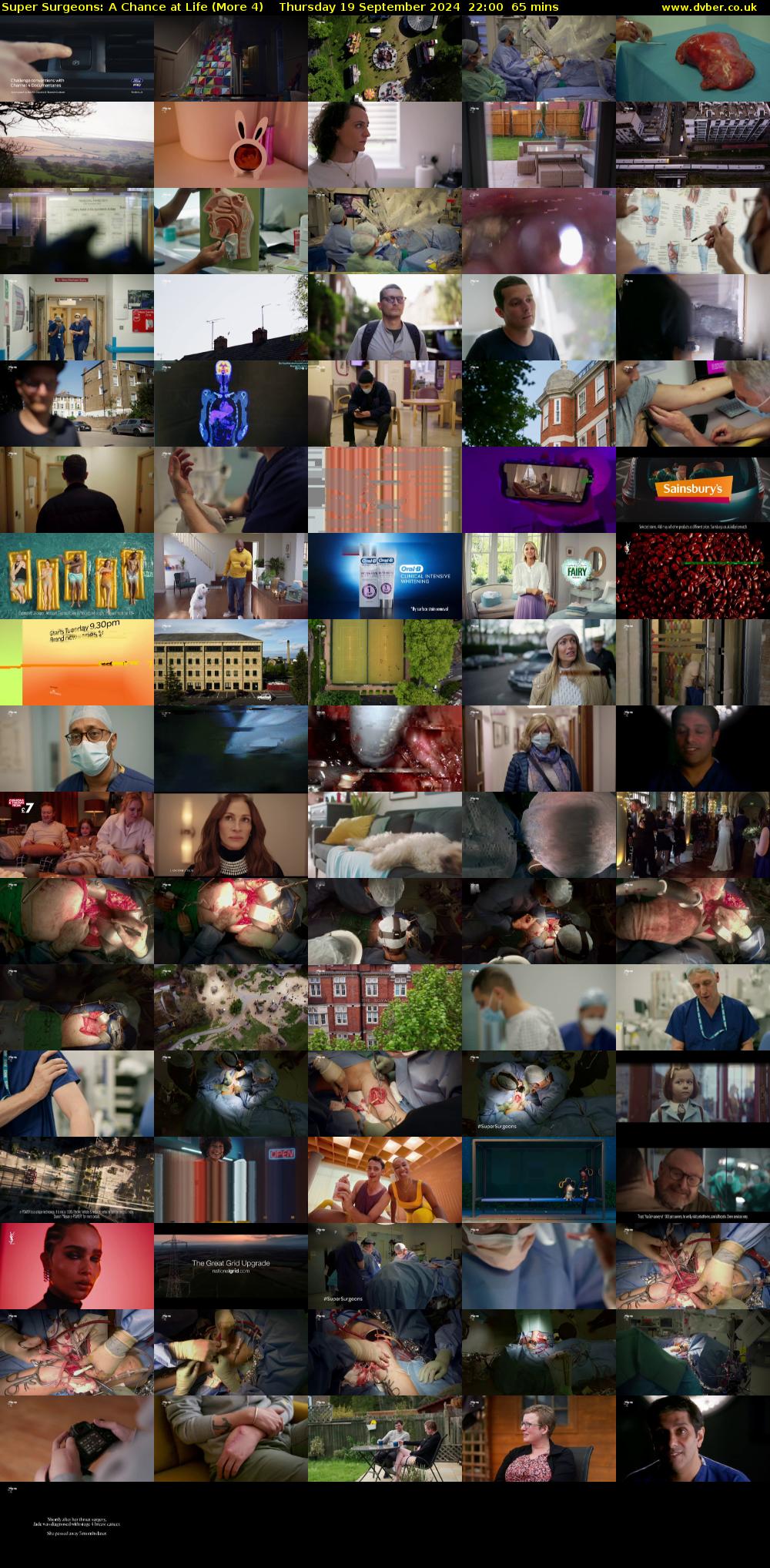 Super Surgeons: A Chance at Life (More 4) Thursday 19 September 2024 22:00 - 23:05