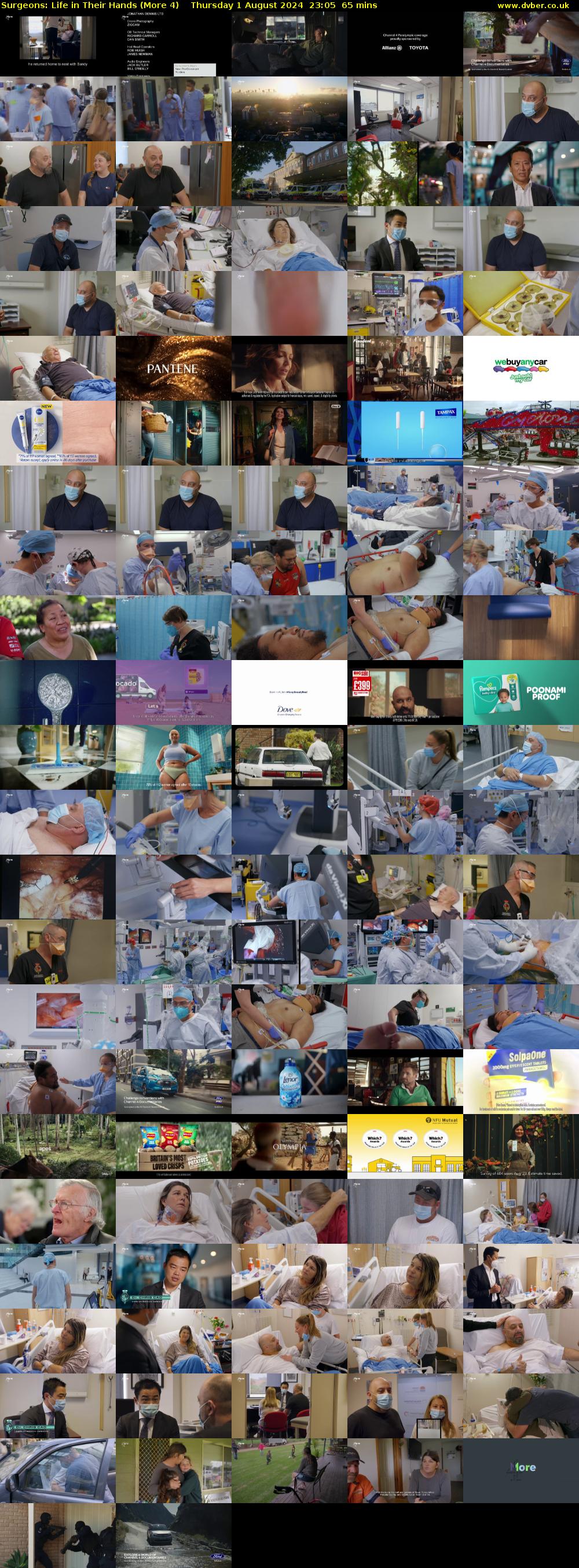 Surgeons: Life in Their Hands (More 4) Thursday 1 August 2024 23:05 - 00:10