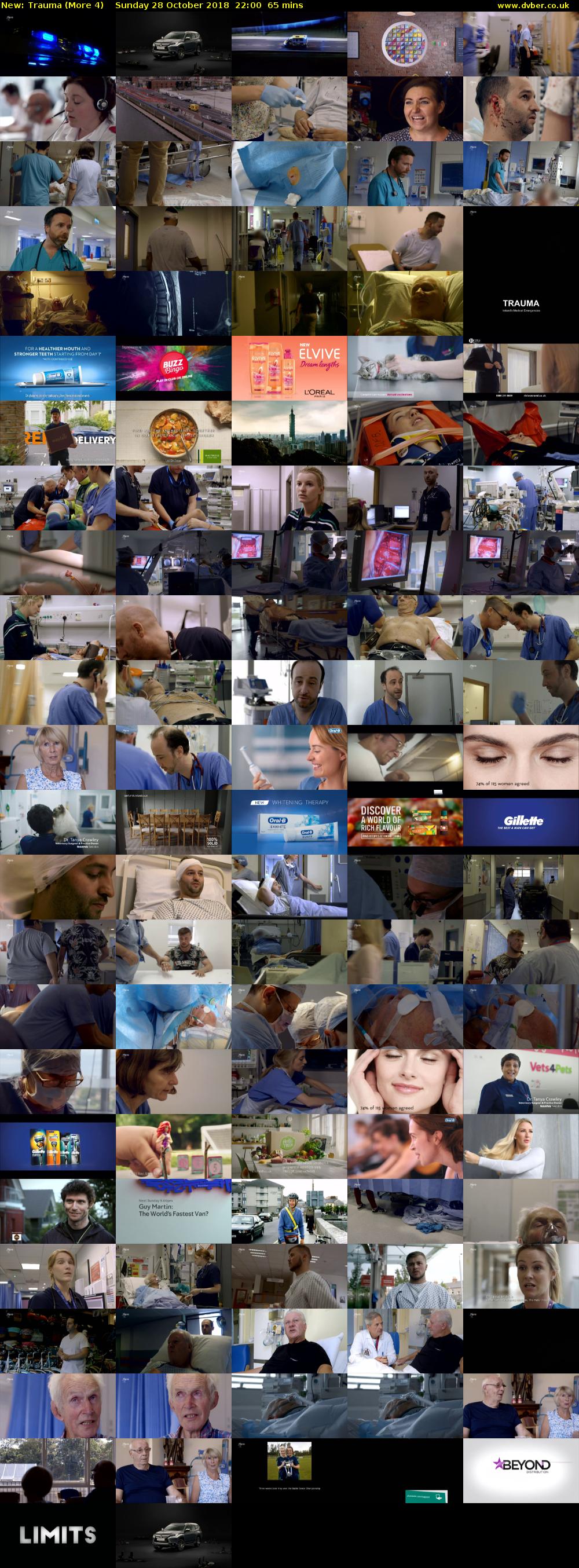Trauma (More 4) Sunday 28 October 2018 22:00 - 23:05