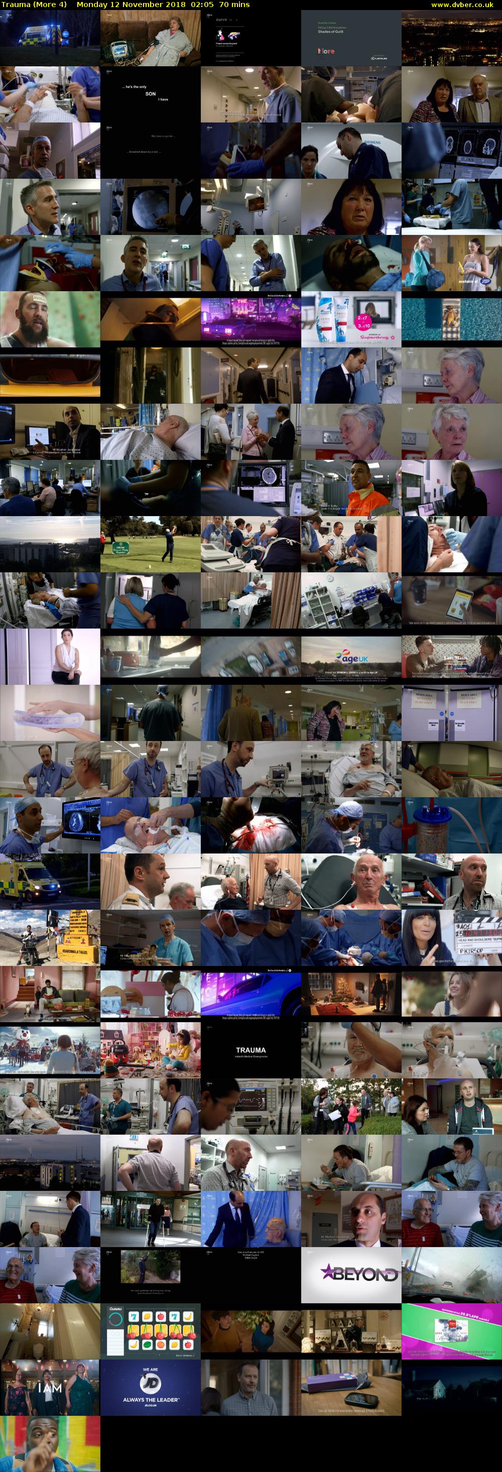 Trauma (More 4) Monday 12 November 2018 02:05 - 03:15