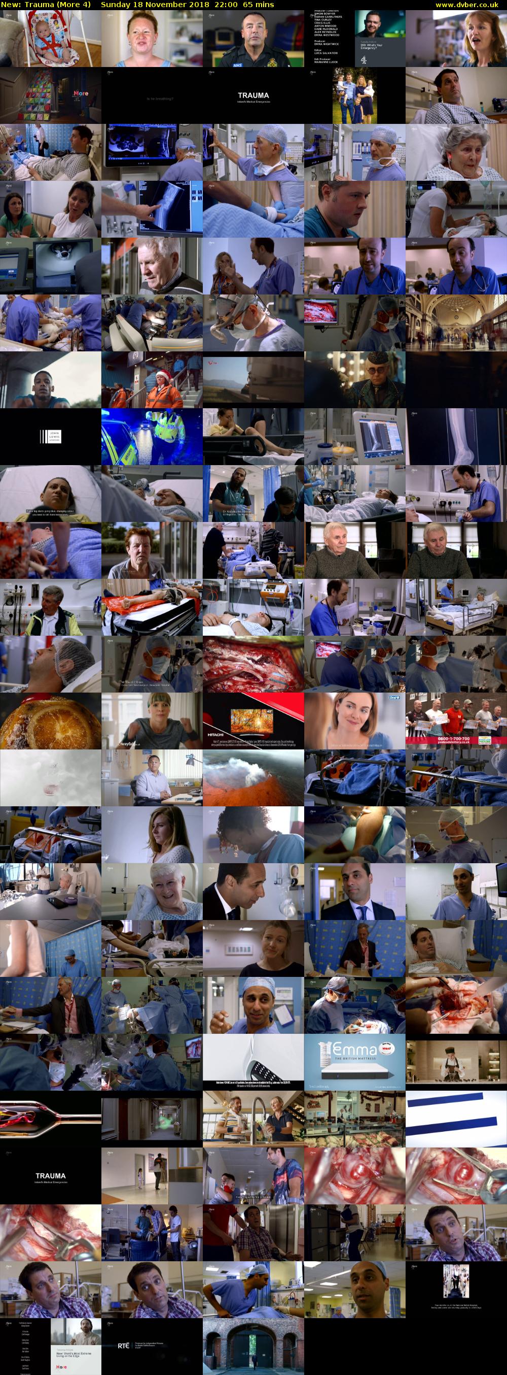 Trauma (More 4) Sunday 18 November 2018 22:00 - 23:05