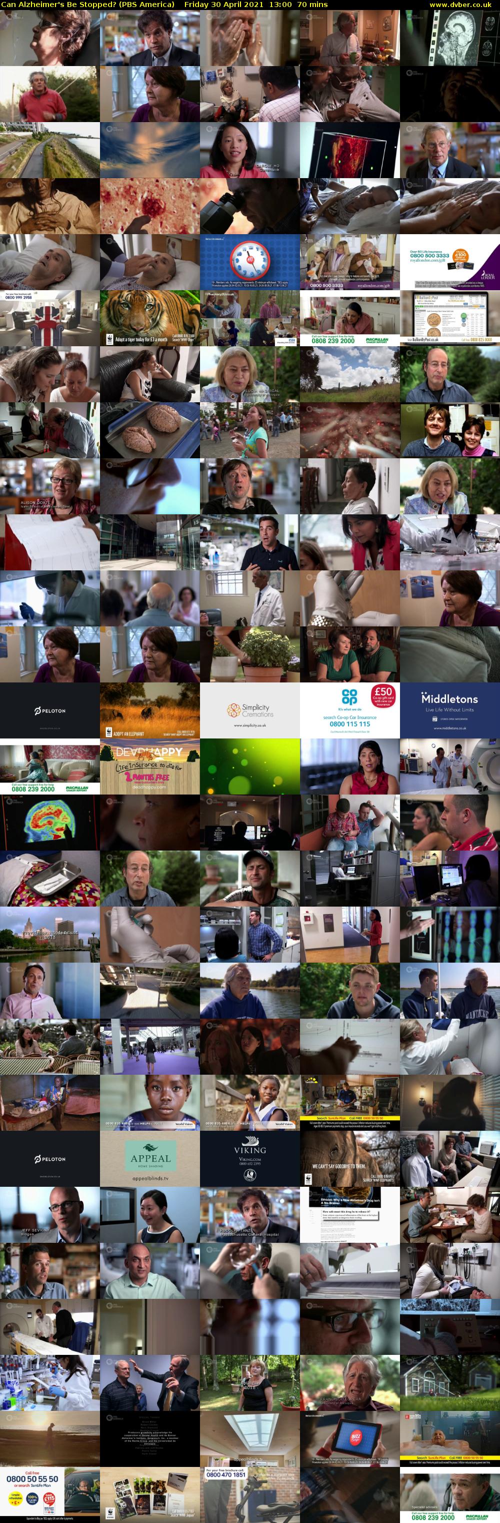 Can Alzheimer's Be Stopped? (PBS America) Friday 30 April 2021 13:00 - 14:10