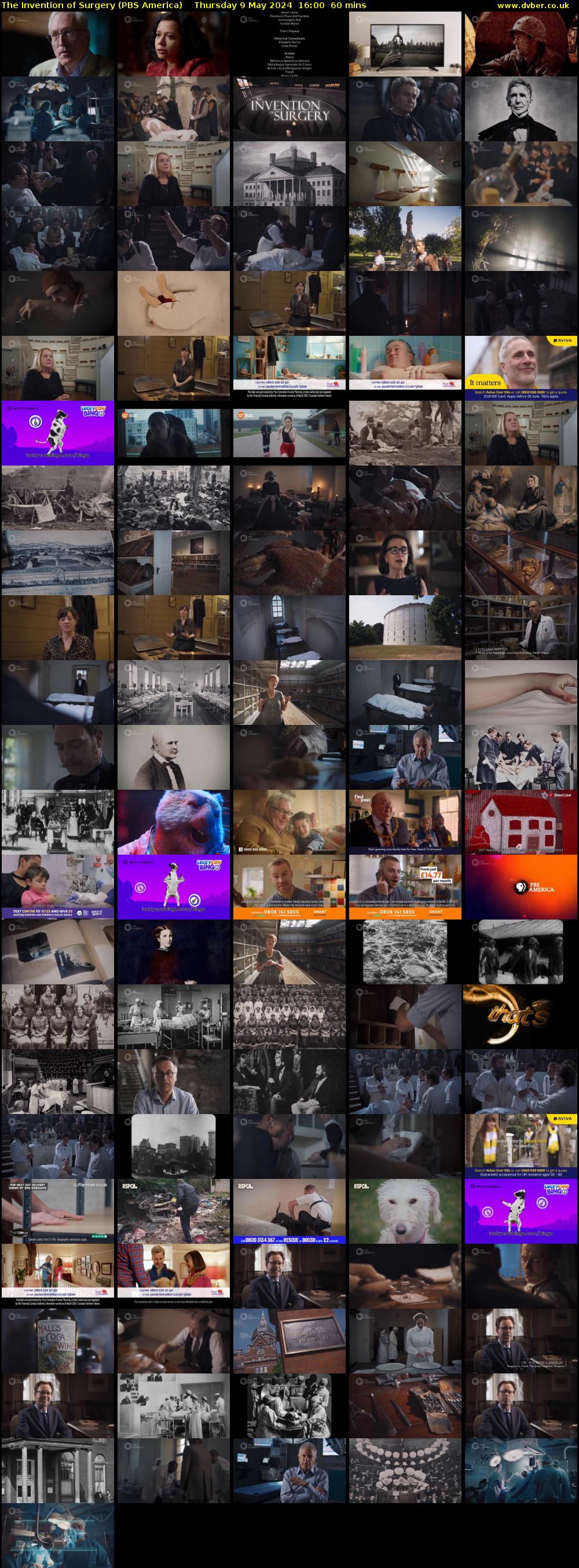 The Invention of Surgery (PBS America) Thursday 9 May 2024 16:00 - 17:00