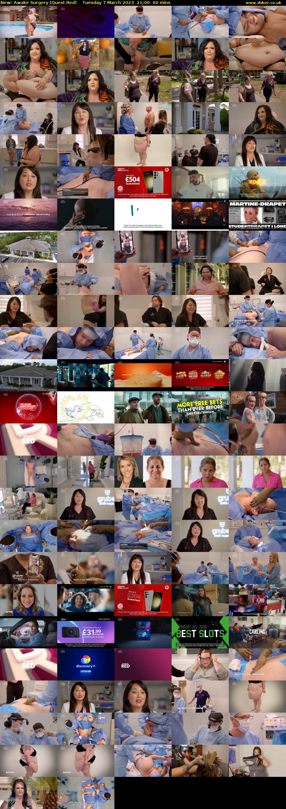 Awake Surgery (Quest Red) Tuesday 7 March 2023 21:00 - 22:00