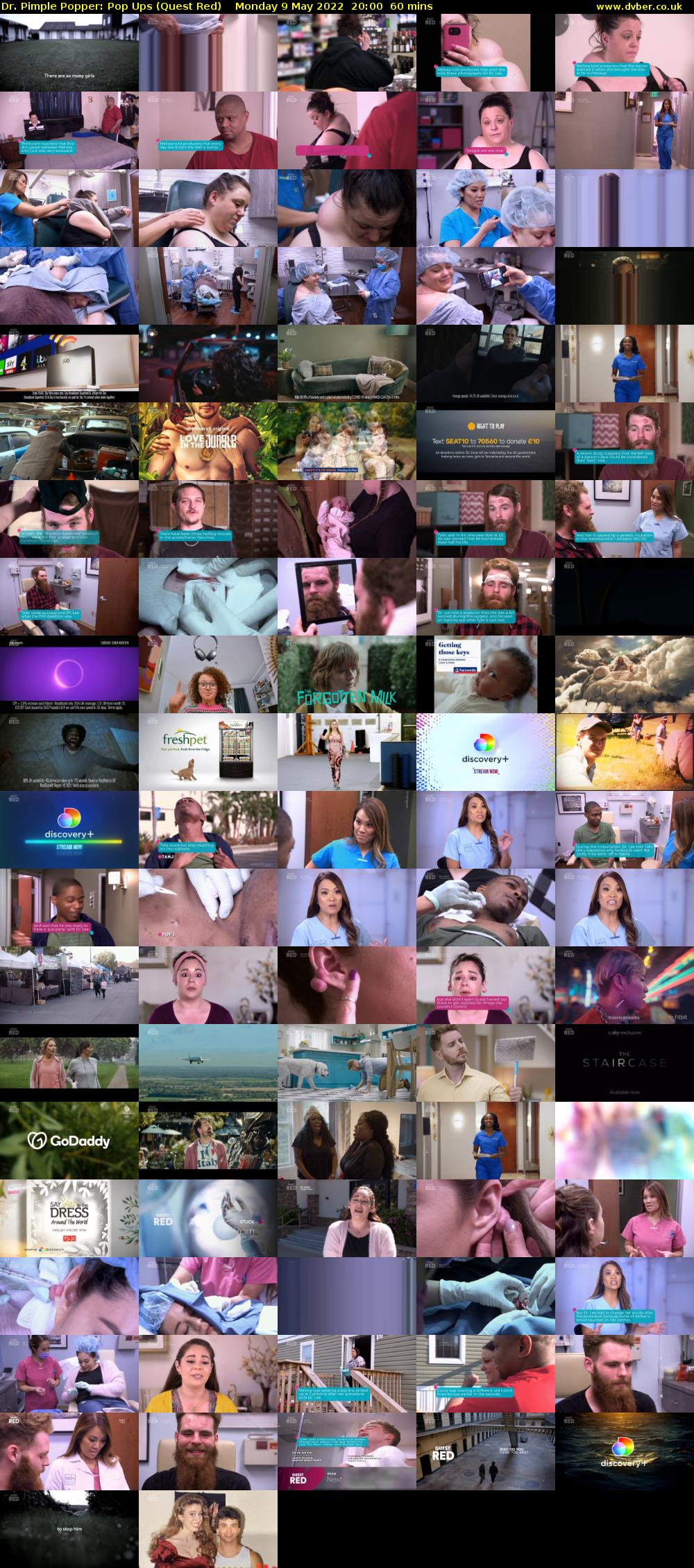 Dr. Pimple Popper: Pop Ups (Quest Red) Monday 9 May 2022 20:00 - 21:00