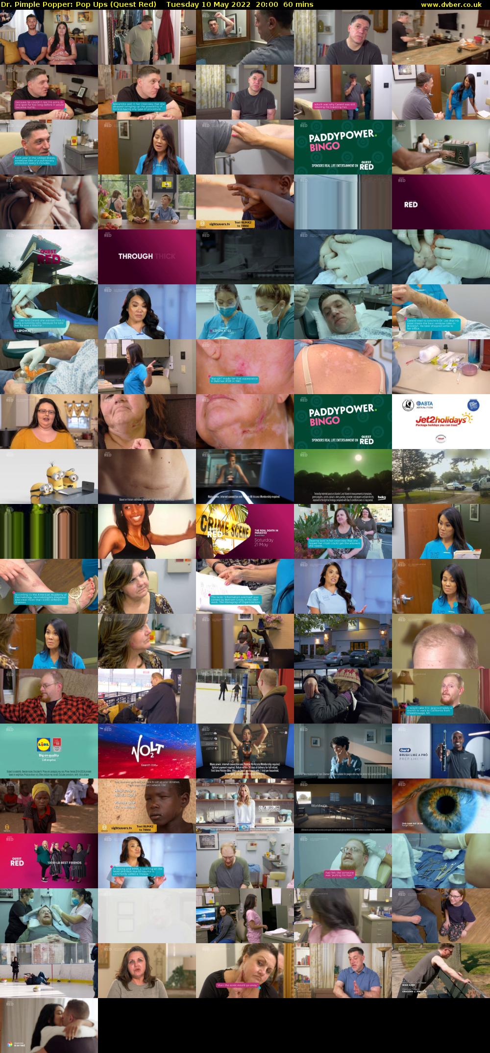 Dr. Pimple Popper: Pop Ups (Quest Red) Tuesday 10 May 2022 20:00 - 21:00