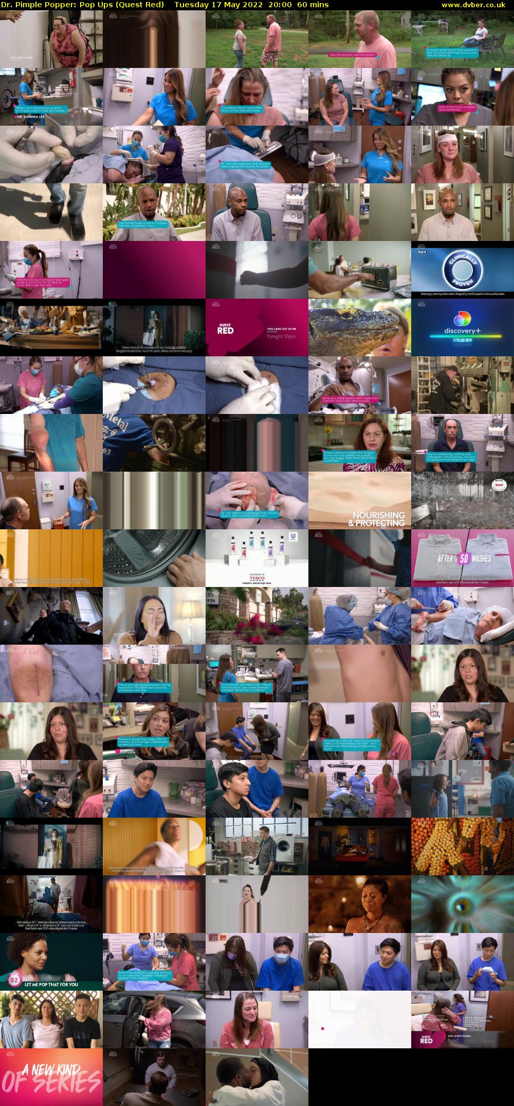 Dr. Pimple Popper: Pop Ups (Quest Red) Tuesday 17 May 2022 20:00 - 21:00