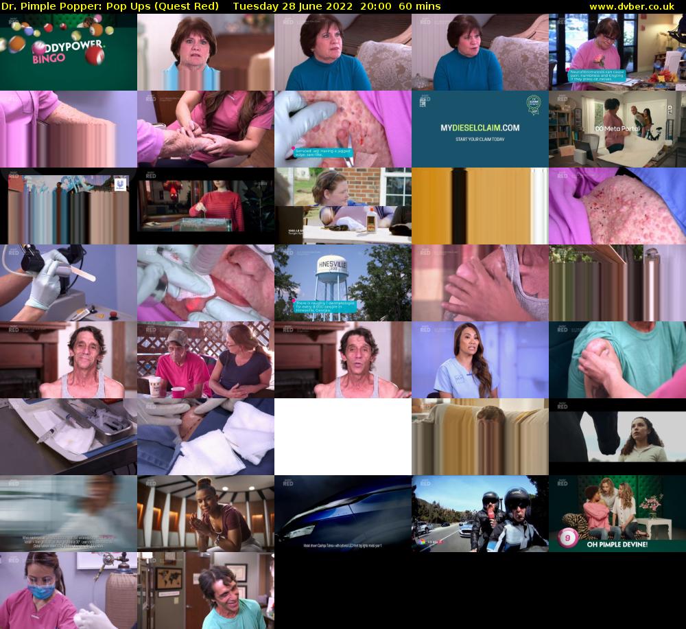 Dr. Pimple Popper: Pop Ups (Quest Red) Tuesday 28 June 2022 20:00 - 21:00