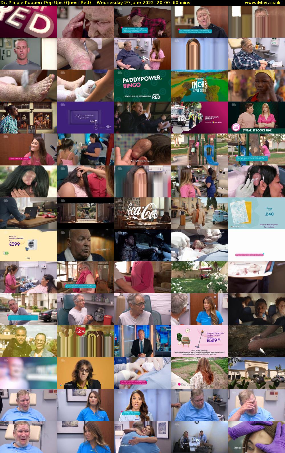 Dr. Pimple Popper: Pop Ups (Quest Red) Wednesday 29 June 2022 20:00 - 21:00