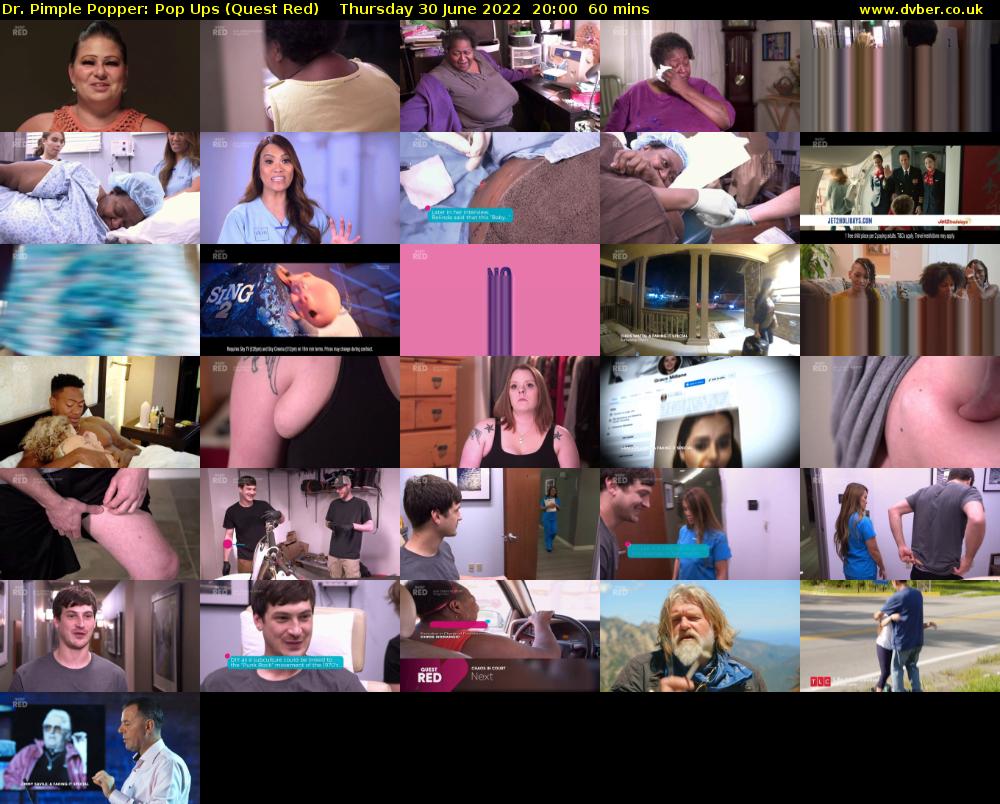Dr. Pimple Popper: Pop Ups (Quest Red) Thursday 30 June 2022 20:00 - 21:00