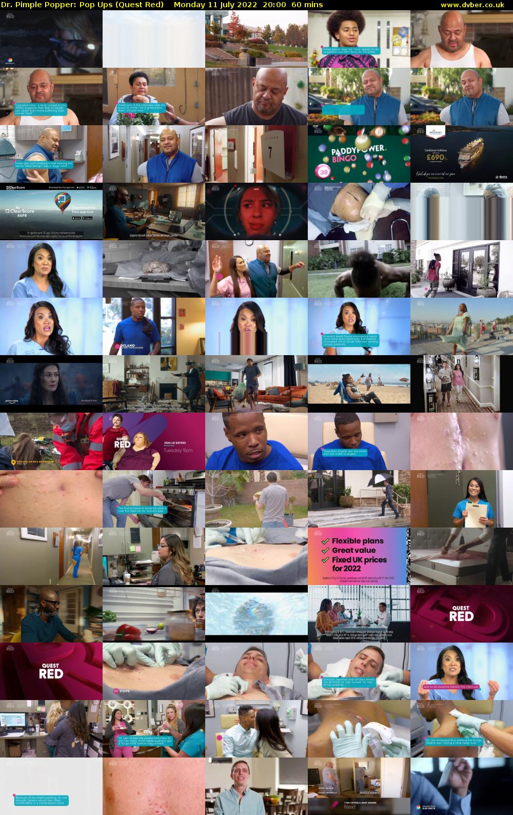 Dr. Pimple Popper: Pop Ups (Quest Red) Monday 11 July 2022 20:00 - 21:00