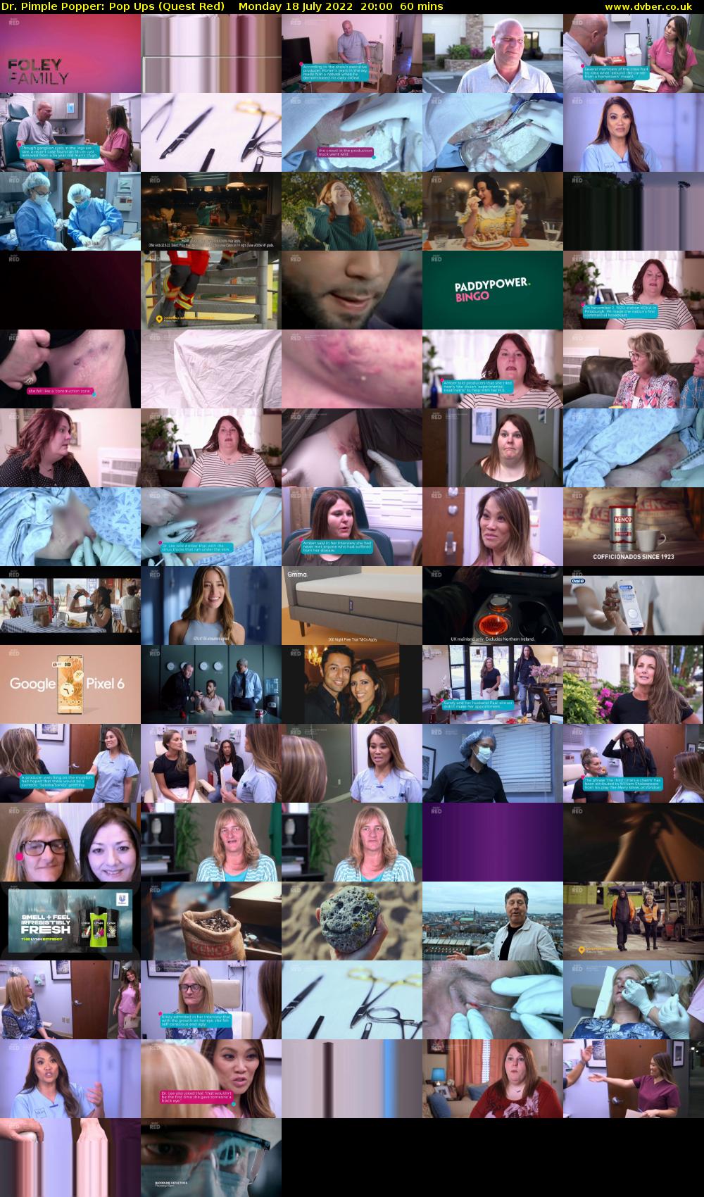 Dr. Pimple Popper: Pop Ups (Quest Red) Monday 18 July 2022 20:00 - 21:00