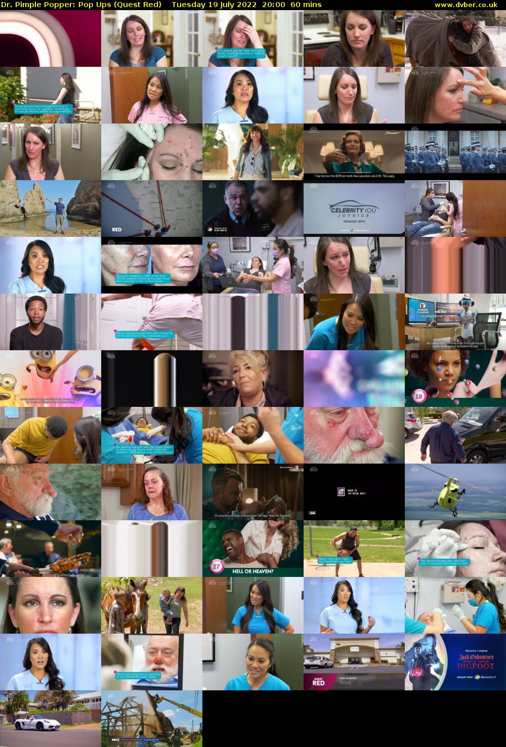 Dr. Pimple Popper: Pop Ups (Quest Red) Tuesday 19 July 2022 20:00 - 21:00