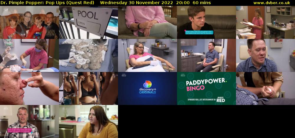 Dr. Pimple Popper: Pop Ups (Quest Red) Wednesday 30 November 2022 20:00 - 21:00
