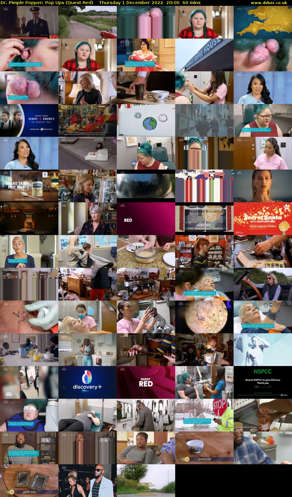Dr. Pimple Popper: Pop Ups (Quest Red) Thursday 1 December 2022 20:00 - 21:00