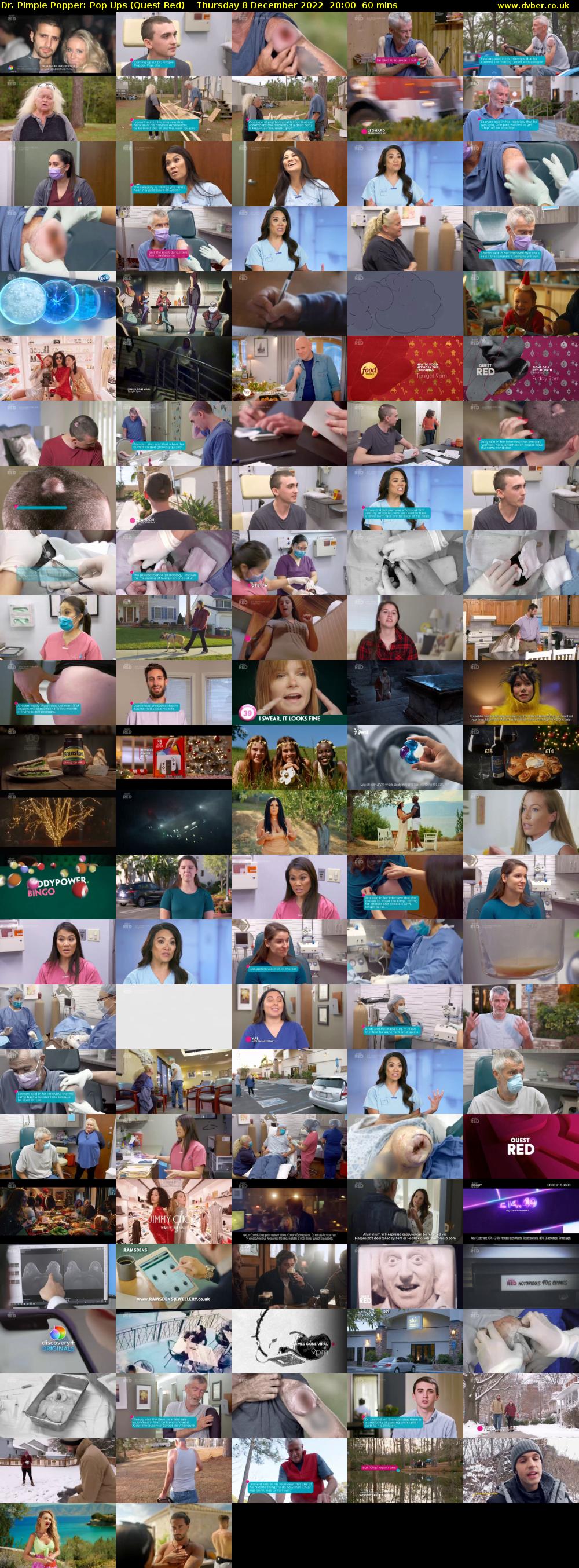 Dr. Pimple Popper: Pop Ups (Quest Red) Thursday 8 December 2022 20:00 - 21:00