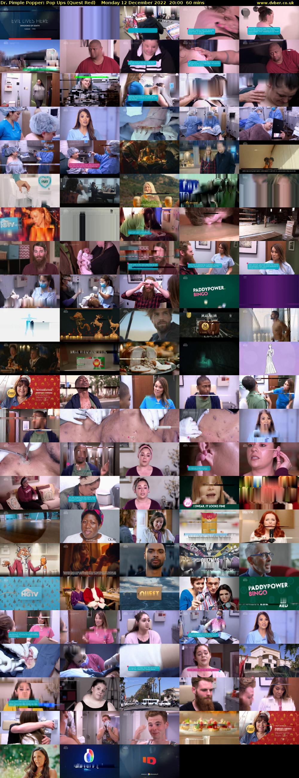 Dr. Pimple Popper: Pop Ups (Quest Red) Monday 12 December 2022 20:00 - 21:00