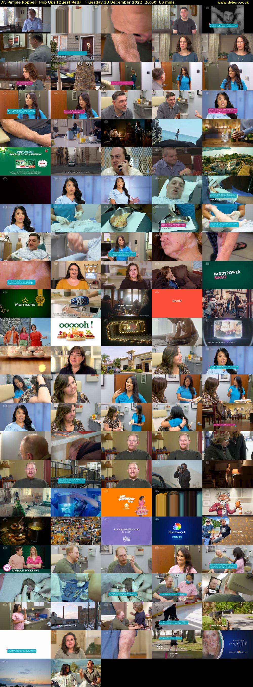 Dr. Pimple Popper: Pop Ups (Quest Red) Tuesday 13 December 2022 20:00 - 21:00